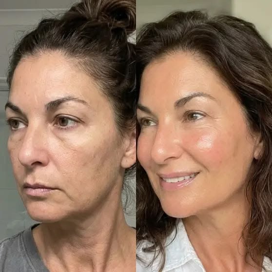 Antes y después visual de rostro con apariencia más luminosa